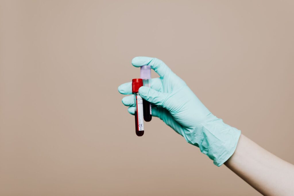 Une main gantée de bleu tient un tube de prélèvement devant un fond uni